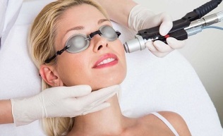 come viene eseguita la procedura per il ringiovanimento della pelle del viso con il laser 