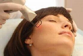 l'essenza della procedura per il ringiovanimento frazionato della pelle del viso con il laser